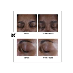 Super Multi-Corrective Eye Zone Treatment -Clinique || Clarins Sales https3A2F2Fimage.s5a.com2Fis2Fimage2FTheBay2F3605972683175 alt33Fwid3D120026hei3D120026qlt3D9026resMode3Dsharp226op usm3D0.92C1.02C82C0 640x