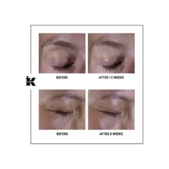 Super Multi-Corrective Eye Zone Treatment -Clinique || Clarins Sales https3A2F2Fimage.s5a.com2Fis2Fimage2FTheBay2F3605972683175 alt43Fwid3D120026hei3D120026qlt3D9026resMode3Dsharp226op usm3D0.92C1.02C82C0 640x