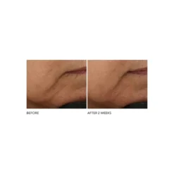 Advanced Retinol & Ferulic Intense Wrinkle Cream -Clinique || Clarins Sales https3A2F2Fimage.s5a.com2Fis2Fimage2FTheBay2F695866572015 alt53Fwid3D120026hei3D120026qlt3D9026resMode3Dsharp226op usm3D0.92C1.02C82C0 640x