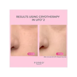 FOREO UFO 2 Power Mask & Light Therapy Device -Clinique || Clarins Sales https3A2F2Fimage.s5a.com2Fis2Fimage2FTheBay2F7350092139632 alt83Fwid3D120026hei3D120026qlt3D9026resMode3Dsharp226op usm3D0.92C1.02C82C0 640x