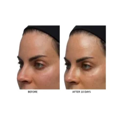 Anti-Aging Algae Niacinamide Moisture Veil -Clinique || Clarins Sales https3A2F2Fimage.s5a.com2Fis2Fimage2FTheBay2F819002016502 alt23Fwid3D120026hei3D120026qlt3D9026resMode3Dsharp226op usm3D0.92C1.02C82C0 640x