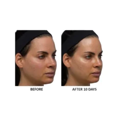 Anti-Aging Algae Niacinamide Moisture Veil -Clinique || Clarins Sales https3A2F2Fimage.s5a.com2Fis2Fimage2FTheBay2F819002016502 alt33Fwid3D120026hei3D120026qlt3D9026resMode3Dsharp226op usm3D0.92C1.02C82C0 640x